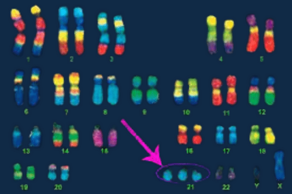 Kromosomer som likner litt på sokker