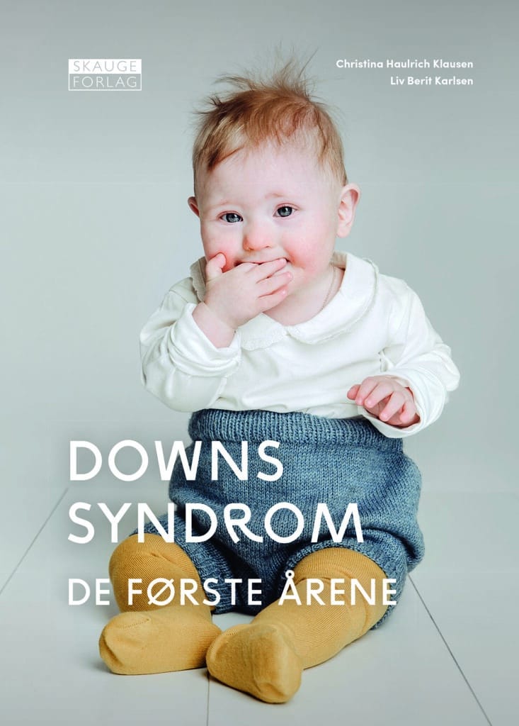 baby med downs syndrom spiser på hånden sin