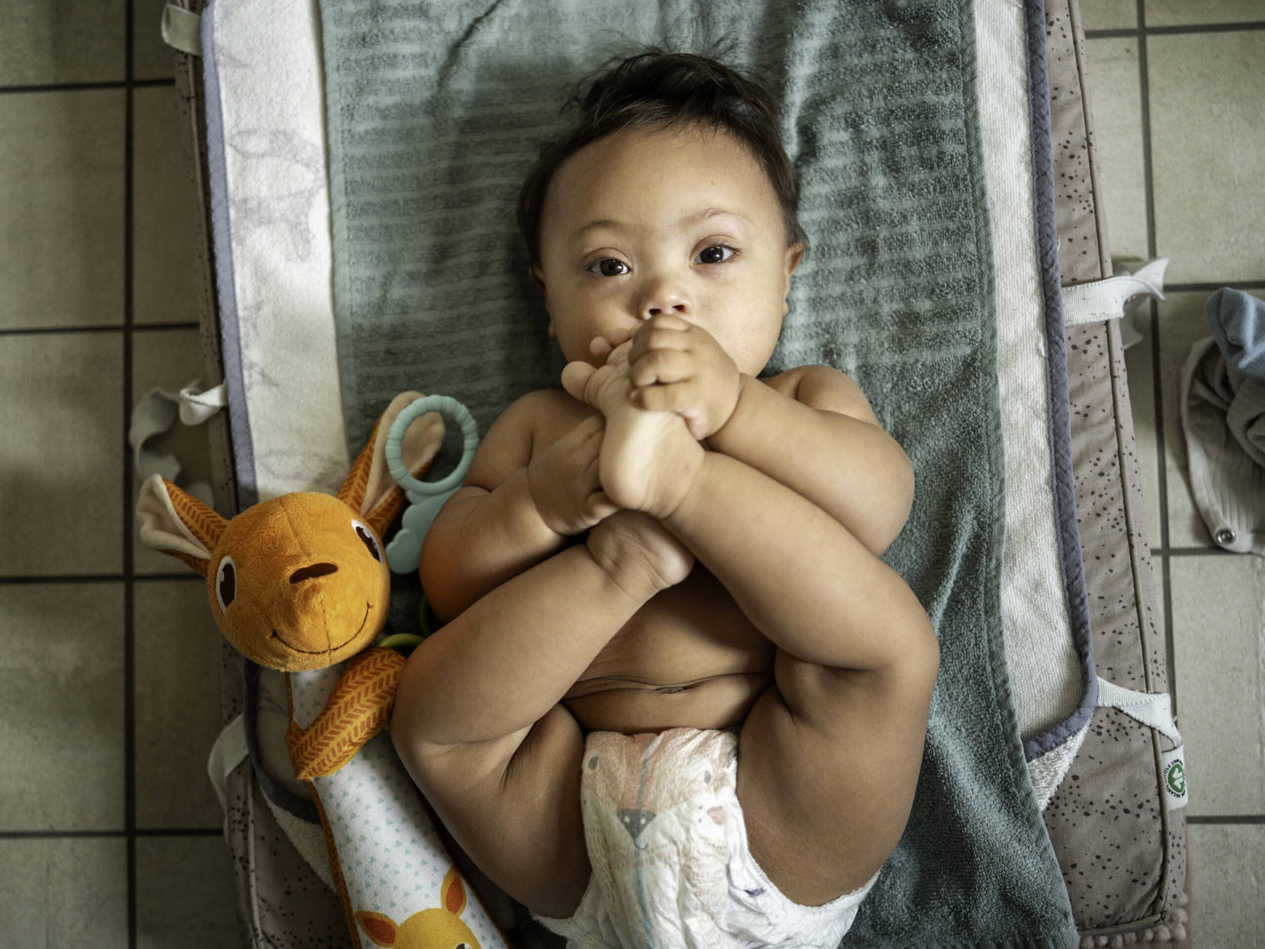 baby med downs syndrom